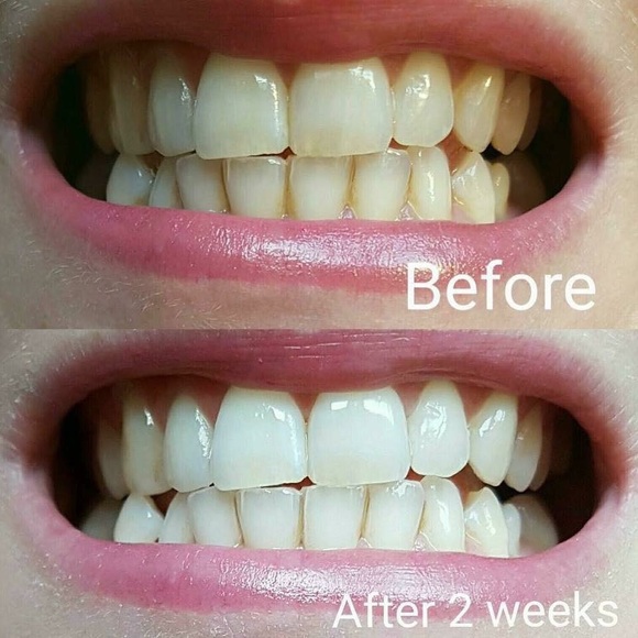 Whitening toothpaste - Picture 2 of 4